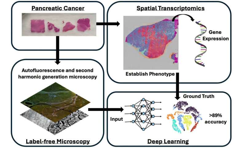 Los investigadores han desarrollado nuevas formas utilizando un feas de cáncer de páncreas. Utilice esta actitud y la transcriptic espacial se expandirá de Tolatiliaticomomion más del 89%. Crédito: T. T. Arizona (como Arizona) La microscopía óptica de IA de IA puede estar recientemente en medicina combinada con IA
